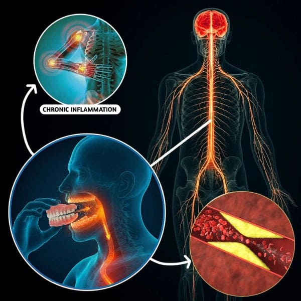 Denture bacteria illustration